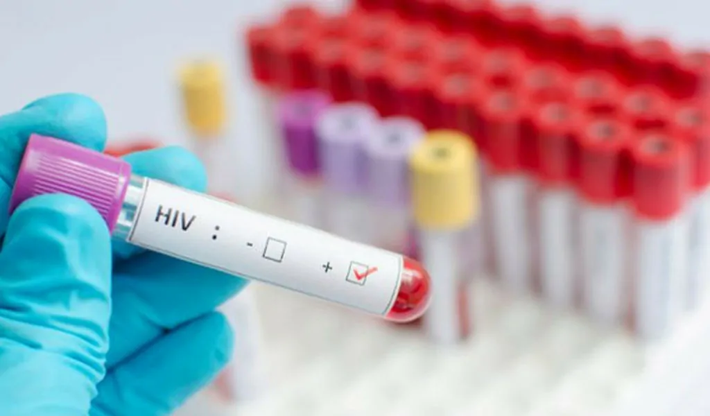 ujian saringan hiv