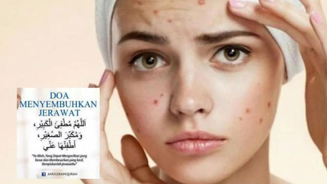 doa jerawat muka